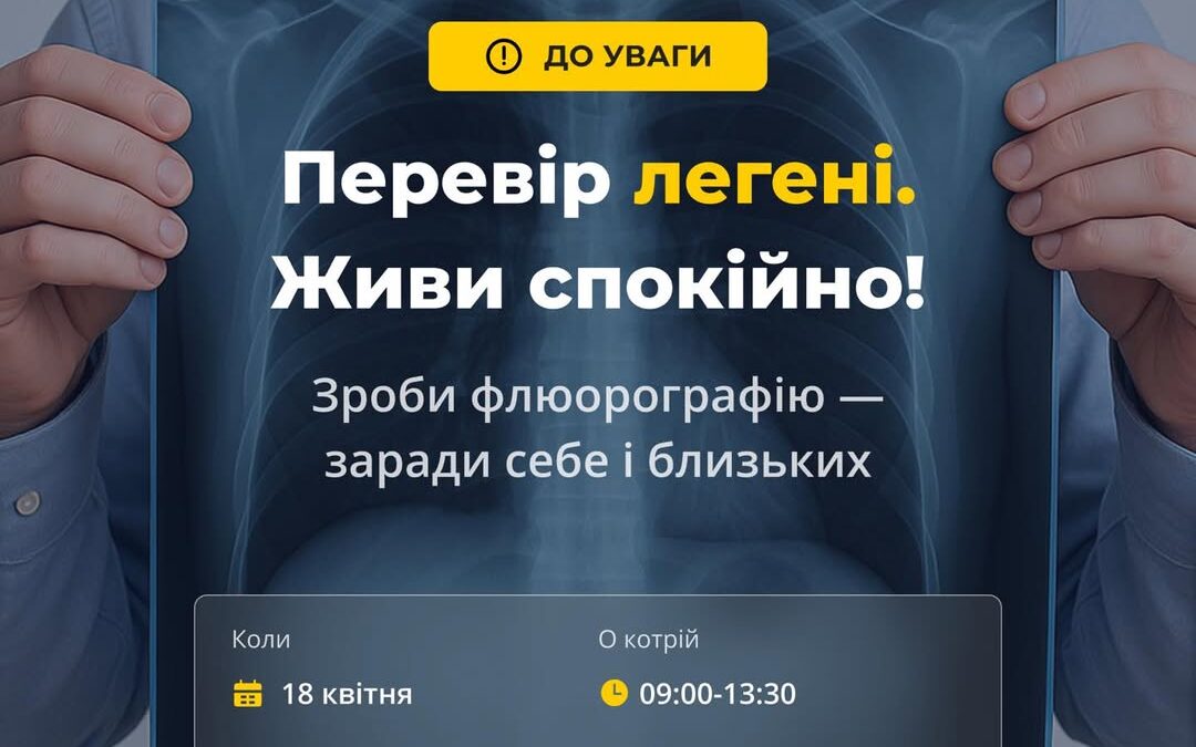 Флюорографічне обстеження в Бучі